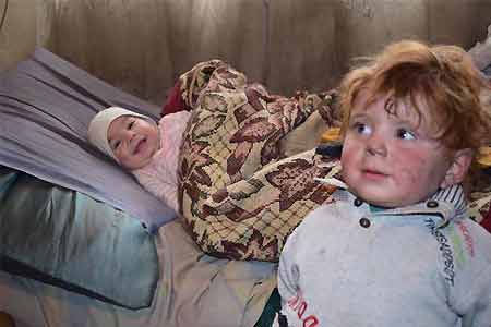FAO representative: 9.6% of children under five years old are undernourished in Armenia