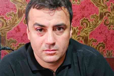 В Ереване вновь избит блогер Артур Чахоян